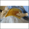 craniotomy_drape